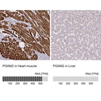 Anti-PGAM2 Antibody