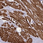 Anti-PGAM2 Antibody