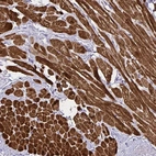 Immunohistochemical staining of human heart muscle shows high expression.