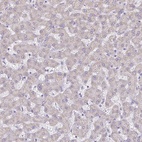 Anti-PGAM2 Antibody