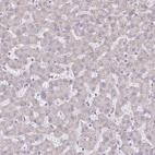 Immunohistochemical staining of human liver shows low expression as expected.