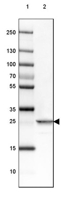 Anti-PGAM2 Antibody