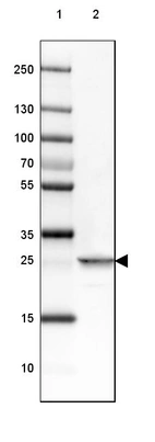 Lane 1: Marker [kDa] 250, 130, 100, 70, 55, 35, 25, 15, 10_br/_Lane 2: Human Skeletal muscle tissue