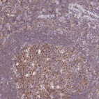 Anti-TPRG1 Antibody