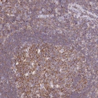 Anti-TPRG1 Antibody
