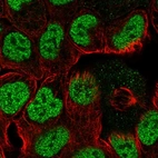 Immunofluorescent staining of human cell line RT4 shows localization to nucleoplasm.