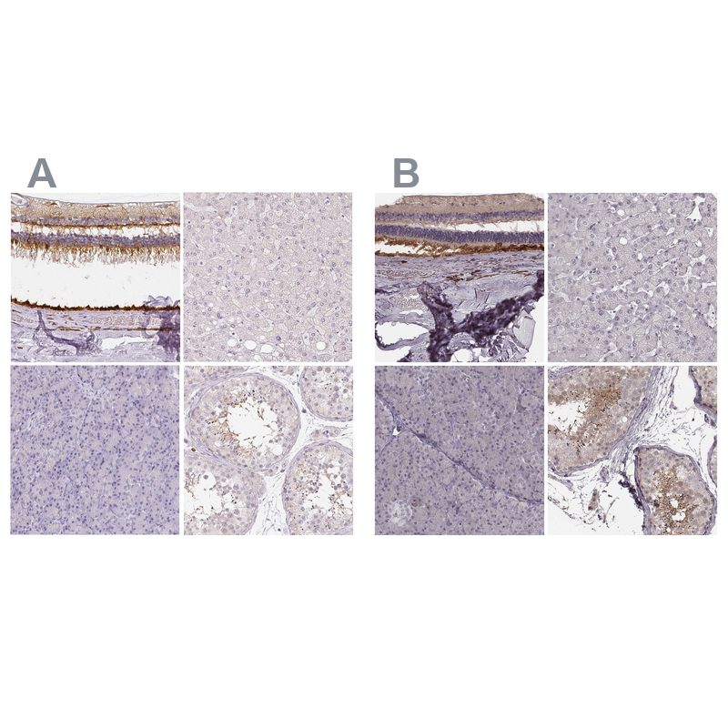 Anti-RPGRIP1 Antibody
