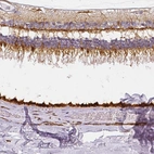Immunohistochemical staining of human eye retina shows moderate positivity in the photoreceptor layer.