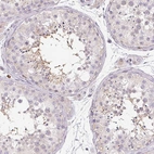 Immunohistochemical staining of human testis shows moderate positivity in late spermatids in seminiferous ducts.