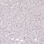 Immunohistochemical staining of human liver shows no positivity in hepatocytes as expected.