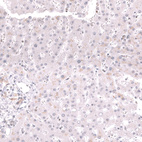 Anti-MSH2 Antibody