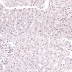 Immunohistochemical staining of human liver shows no nuclear positivity in hepatocytes as expected.