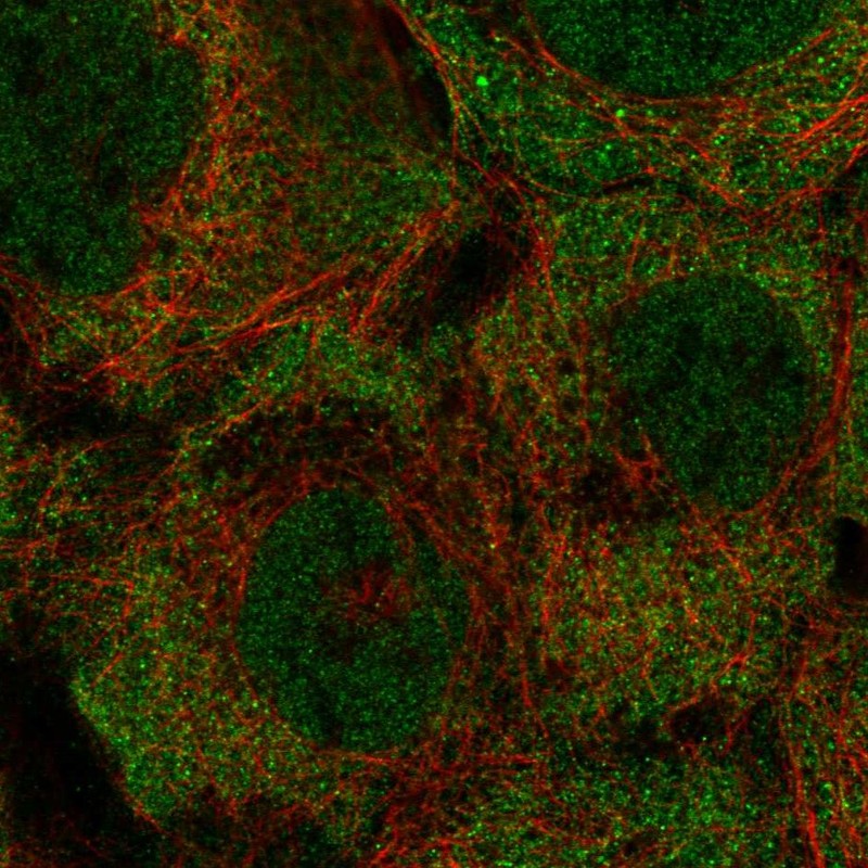 Anti-KRTCAP3 Antibody