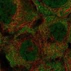 Anti-KRTCAP3 Antibody