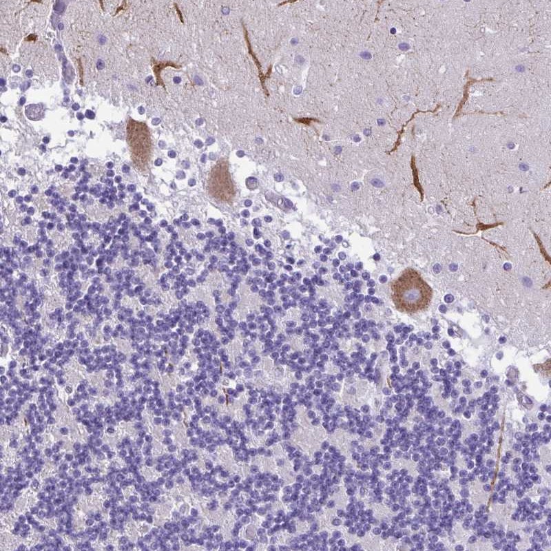 Anti-PAK3 Antibody