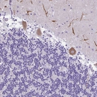 Anti-PAK3 Antibody