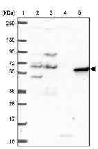 Lane 1: Marker [kDa] 250, 130, 95, 72, 55, 36, 28, 17, 10_br/_Lane 2: Human cell line RT-4_br/_Lane 3: Human cell line U-251 MG_br/_Lane 4: Human plasma_br/_Lane 5: Human Liver tissue
