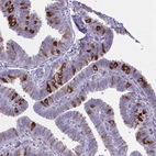 Anti-PITPNM1 Antibody