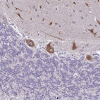 Immunohistochemical staining of human cerebellum shows moderate cytoplasmic positivity in Purkinje cells.