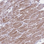 Immunohistochemical staining of human Heart muscle shows moderate cytoplasmic positivity in cardiomyocytes.