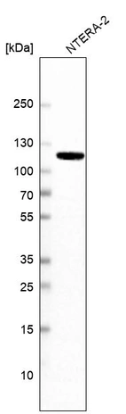 Western blot analysis in human cell line NTERA-2.