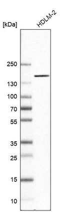Western blot analysis in human cell line HDLM-2.