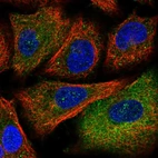 Immunofluorescent staining of human cell line A549 shows localization to cytosol & cytoplasmic bodies.