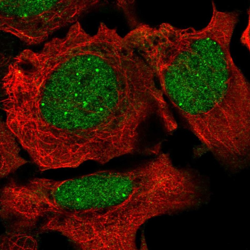 Anti-NCOA2 Antibody