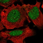 Anti-NCOA2 Antibody