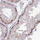 Immunohistochemical staining of human testis shows high expression.