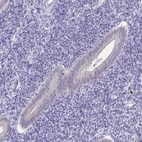 Immunohistochemical staining of human endometrium shows low expression as expected.