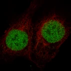 Immunofluorescence staining in NTERA-2 cell line with Anti-MSH2 monoclonal antibody, showing specific staining of nucleoplasm in green. Microtubule- and nuclear probes are visualized in red and blue respectively (where available).