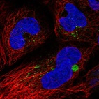 Anti-C19orf81 Antibody