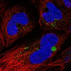 Immunofluorescent staining of human cell line HEK 293 shows localization to aggresome & vesicles.