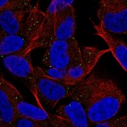 Anti-MYT1L Antibody