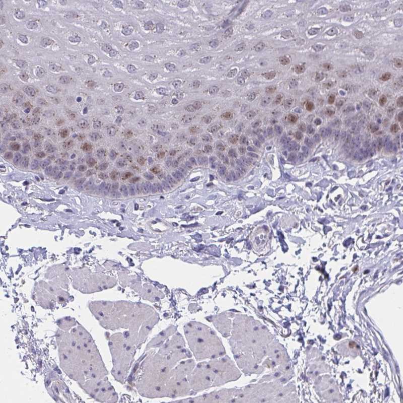 Anti-ZNF554 Antibody