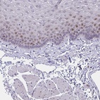 Anti-ZNF554 Antibody