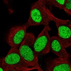 Immunofluorescent staining of human cell line SH-SY5Y shows localization to nucleoplasm.