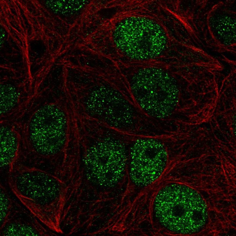 Anti-ZHX1 Antibody