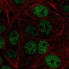 Anti-ZHX1 Antibody