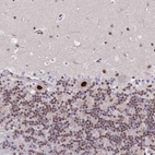Immunohistochemical staining of human cerebellum shows strong nuclear positivity in Purkinje cells.
