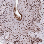 Immunohistochemical staining of human skin shows strong nuclear positivity in squamous epithelial cells.