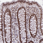 Immunohistochemical staining of human colon shows moderate nuclear positivity in glandular cells.