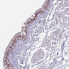 Anti-PRR14 Antibody