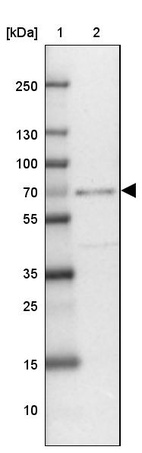 Anti-ZNF432 Antibody