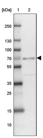 Lane 1: Marker [kDa] 250, 130, 100, 70, 55, 35, 25, 15, 10_br/_Lane 2: Human Liver tissue