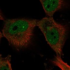 Anti-ELF4 Antibody