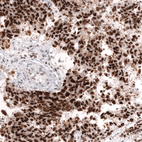 Anti-MSH2 Antibody