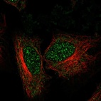 Anti-ZNF594 Antibody