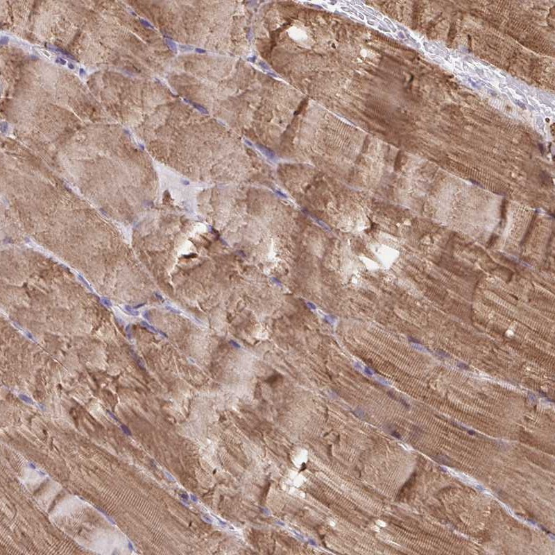 Anti-KLHL34 Antibody